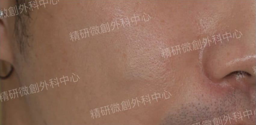 1 1